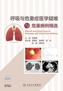 我的老婆在对门